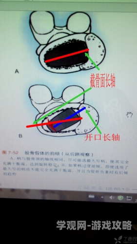 嫩汁(骨科 h)探索骨科医学中的创新技术与未来趋势嫩汁(骨科 h)自慰
