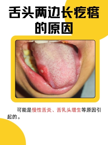 健康科普舌部异常感觉的医学解读 可能是这些健康信号舌头喷水怎么回事